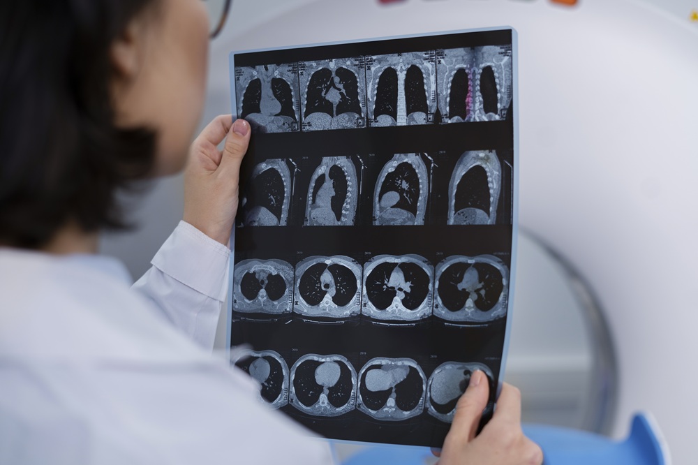 CT Scan